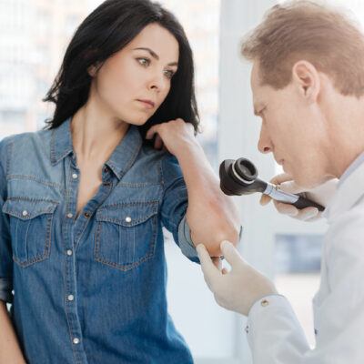 Psoriasis – Symptoms, Causes, and Management